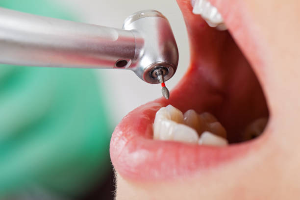 Best Emergency Denture Repair in Buchanan Dam, TX